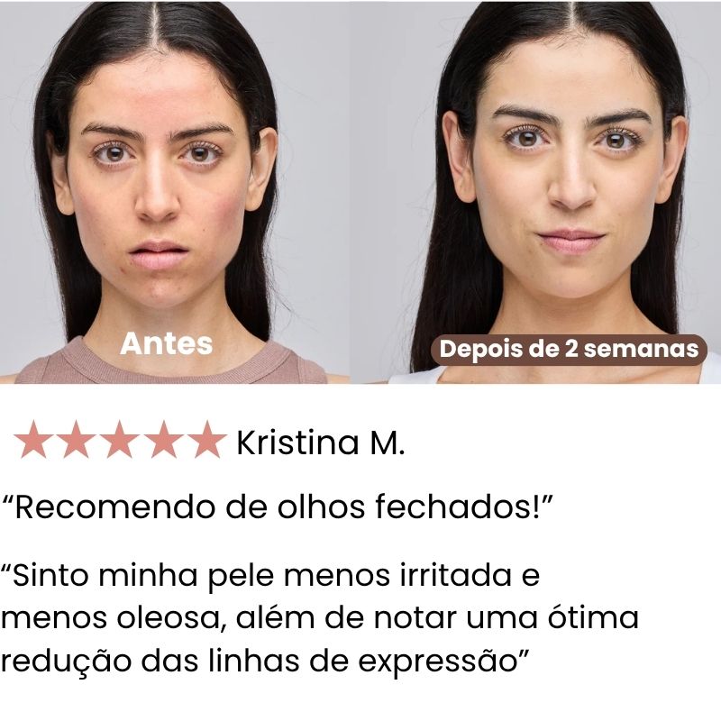 Lifora - Máscara Terapia Facial