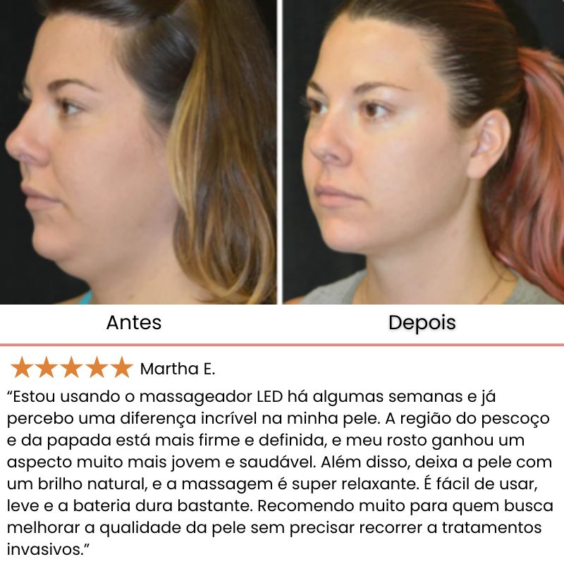 Lumea - Massageador Lift Facial