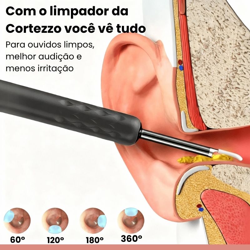 Otosense - Limpador de ouvido visual